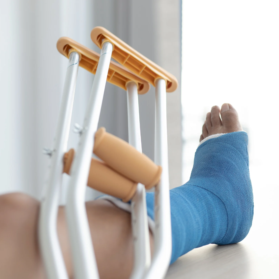 A foot in a cast propped up next to crutches